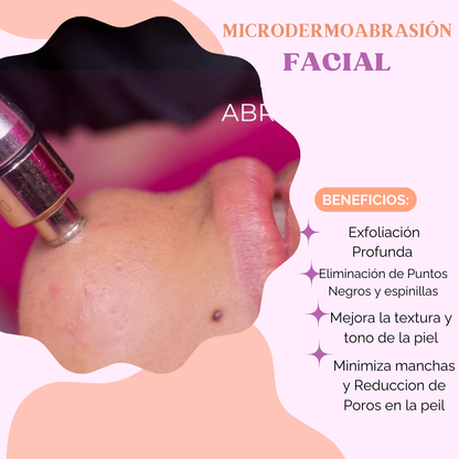 MICRODERMOABRASIÓN FACIAL