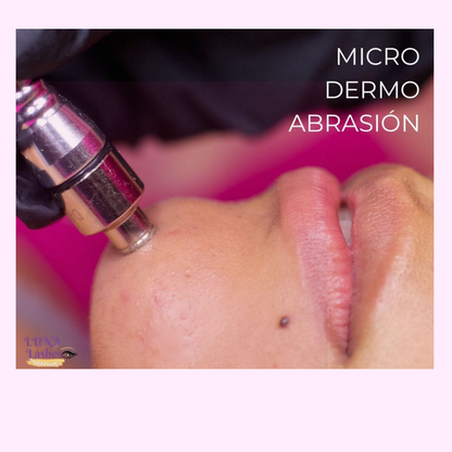 MICRODERMOABRASIÓN FACIAL